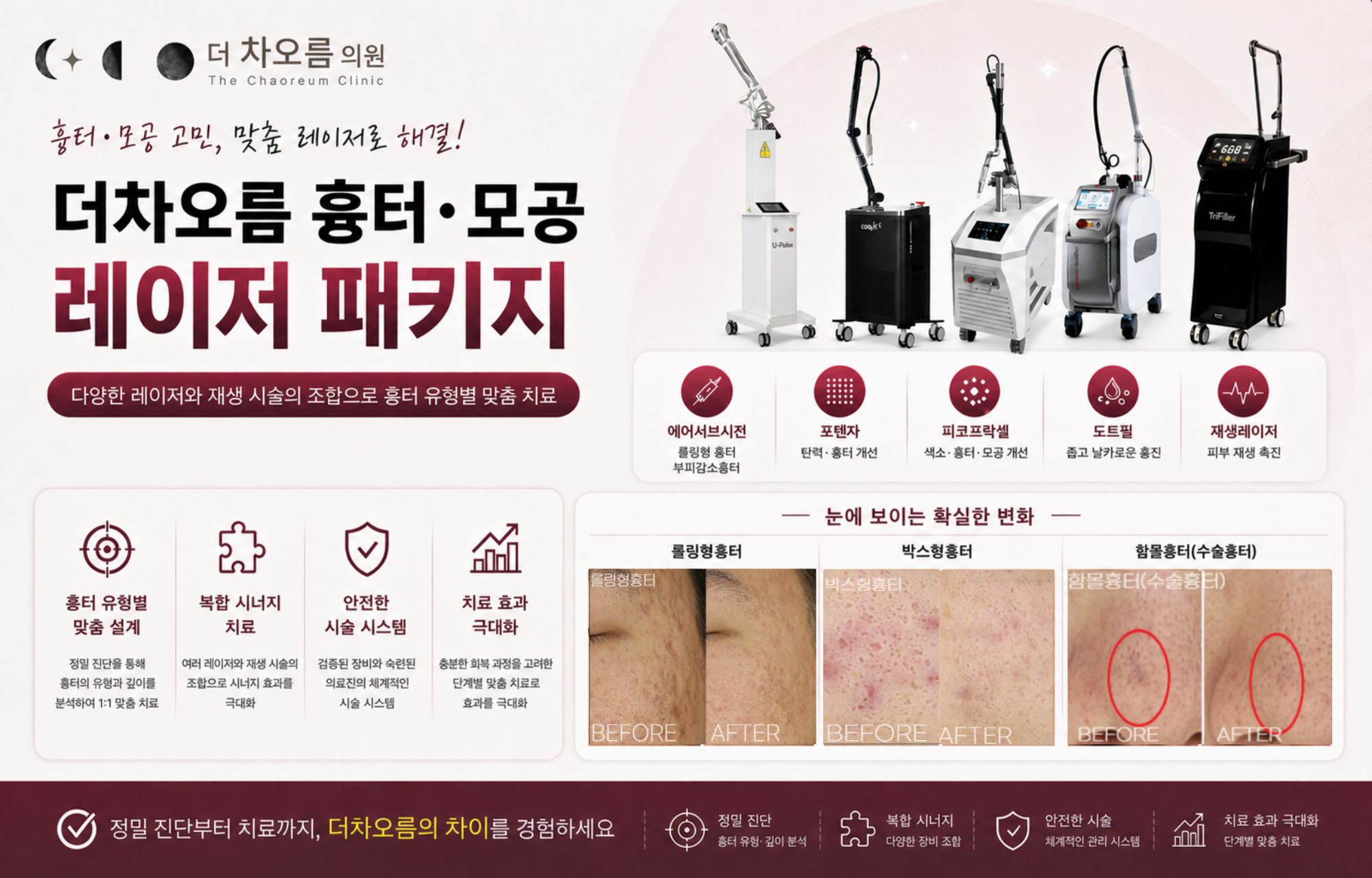 팝업이미지
